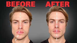 How to Fix Asymmetrical Jaw amp Face FOREVER [upl. by Monagan]