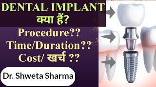 Dental Implant Procedure Cost in india amp treatment duration Dental Implant procedure in hindi [upl. by Apoor574]