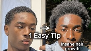 How To Grow Hair Quickly With This 1 Secret Tip [upl. by Aidnama]