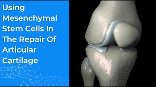 Using Mesenchymal Stem Cells In The Repair Of Articular Cartilage [upl. by Novyad]