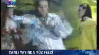 Ismail YK Yüz FeLçi Haberi  Show tw [upl. by Tenaej809]