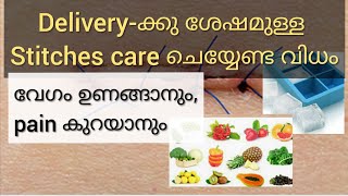 How to Care Stitches after delivery MalayalamTips for Pain relief and Easy recovery Malayalam [upl. by Dugan]