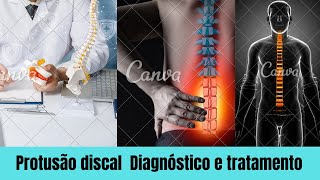 Protusão discal Diagnóstico e tratamento [upl. by Blim925]