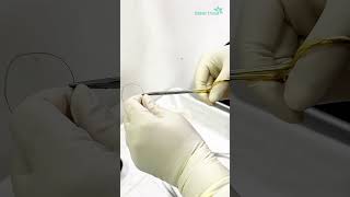 Biopsy for histopathology  Dhaka Dermatology Institute  LaserTreat [upl. by Eiramave]