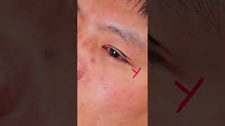 tutorial double eyelids shorts [upl. by Ttej57]