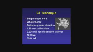 Pre Ablation Cardiac CT [upl. by Seward994]