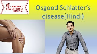 Osgood Schlatter Disease Hindi [upl. by Skutchan219]