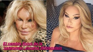 El cambio físico de la catwoman Jocelyn Wildenstein [upl. by Airtemed]