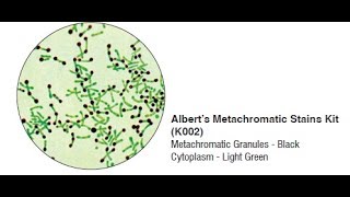 Alberts Stain Neissers stain for C diphtheria demo [upl. by Bancroft]