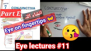 Eye lectures 11 Ptergium fibrovasular connective tissue of conjunctiva conjunctivitis eye [upl. by Margie]