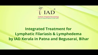 Haathi Paon  Integrated Treatment  Filariasis  Lymphedema  IAD  Bihar  Patna [upl. by Arramat]