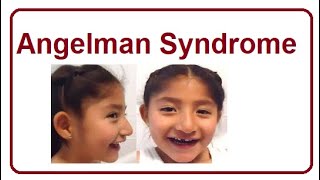 Angelman Syndrome  Key Facts amp Symptoms  2024 [upl. by Llirret]