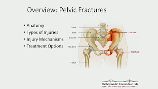 Treatment of Common Geriatric Fractures Spine and Pelvis [upl. by Annaxor]