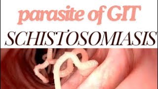 Parastology schistosomiasis 🪱 part 2 [upl. by Auroora472]