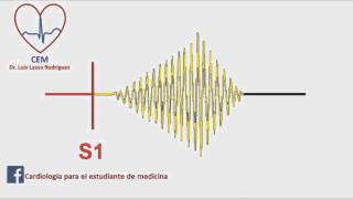 Soplo de la estenosis aortica [upl. by Htebharas]