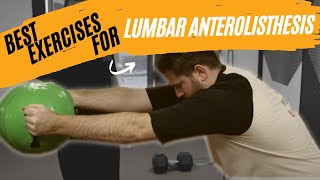 Best Exercises for Lumbar Anterolisthesis [upl. by Lardner396]