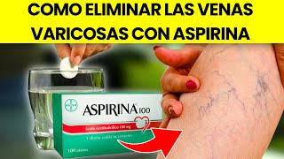 ¡Increíble El Secreto de la Abuela para Deshacerte de las Varices en Solo 7 Días [upl. by Gnas247]