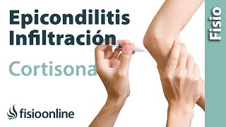 Epicondilitis o codo de tenista y las infiltraciones de cortisona o corticoides [upl. by Mcclary]