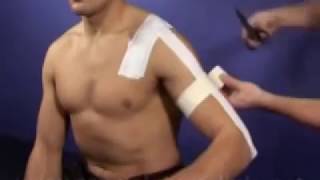 AC acromioclavicular Joint Taping Technique [upl. by Oicnerual]