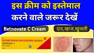 Betnovate c skin cream review  Betnovate c lagane se kya hota hai [upl. by Eamaj]