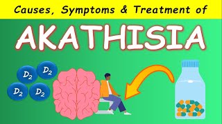 Akathisia by Antipsychotics  Causes Symptoms and Treatments [upl. by Scutt]