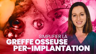 Simplifier la greffe osseuse perimplantaire [upl. by Philippine]