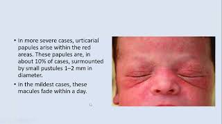 Lecture 203 Dermatoses of the Neonates Part1 Rook10th ed Ch 114 [upl. by Ploss10]