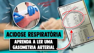 GASOMETRIA Arterial de uma Acidose Respiratória │ Medicina Resumida [upl. by Muffin]