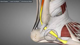 Peroneus tendinopathie  tendinitis [upl. by Seraphim]