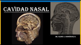 CAVIDAD NASAL [upl. by Dillon]