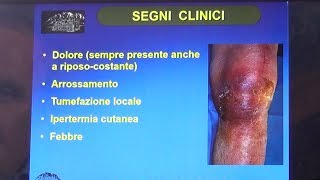 Algoritmo diagnostico terapeutico delle Infezioni OsteoArticolari  2° Parte [upl. by Aidyl84]