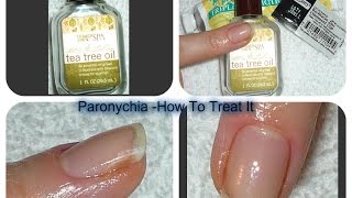 Acute Chronic PARONYCHIA Treatments [upl. by Nickolai722]