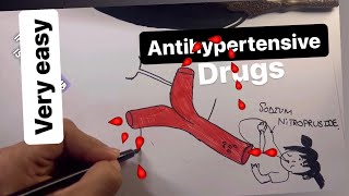 anti hypersensitive drugs pharmacology mnemonics part 7 [upl. by Pammi603]