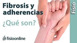 Fibrosis y adherencias en lesiones y heridas  Qué es causas e importancia [upl. by Weixel]