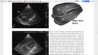 CLINICAL EMERGENCY RADIOLOGY CAMBRIDGE [upl. by Enaile]