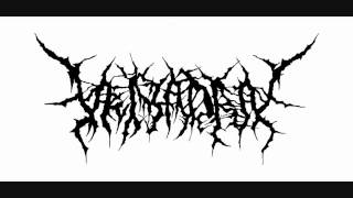 【Veiyadra】 Putrid Infection→Sanguineous Mortuary Brutal Death Metal [upl. by Leahcimnhoj]