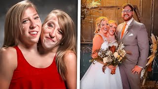 Conjoined Twins Abby and Brittany Hensel Got Married [upl. by Ludlow528]