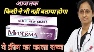 Mederma cream  Mederma for acne scars  Mederma advanced scar gel review [upl. by Nager]