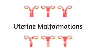 Uterine Malformations  Embryology  Gynecology  High Yield  USMLE  NEET PG  INICET [upl. by Dunkin]