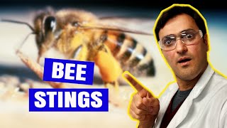 How to Treat BEE STINGS At Home [upl. by Kliman905]