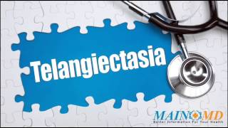 Telangiectasia ¦ Treatment and Symptoms [upl. by Brigit]