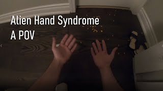 Alien Hand Syndrome  A First Person POV [upl. by Annayad466]