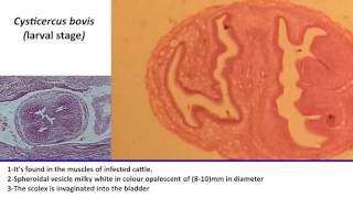 33 Practical Parasitology  Cysticercus Bovis  Larval Stage [upl. by Grenville]