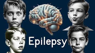 Epilepsy in Children  Simply Explained [upl. by Navillus964]