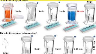 Trichrome stain in 1 minute [upl. by Dominica]
