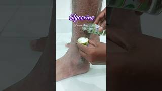 🔥Get Rid of Dry cracked Hands skincareskincaretips skincareroutine snmakeuptutoria crackedhand [upl. by Fillander564]