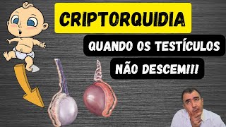 O testículo não desceu criptorquidia Meu filhinho tem esse problema doutor [upl. by Odrarebe76]