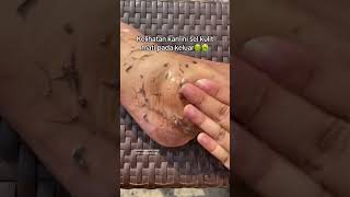 Deep Cleansing Remove Dust and Dead Skin ameenbeautytips GlowAndCleanByAmeen [upl. by Tanah]