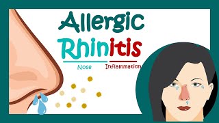 Allergic rhinitis  What is Allergic Rhinitis  What is the main cause of allergic rhinitis [upl. by Temple219]