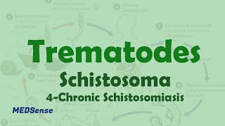 Schistosoma 4 Chronic Schistosomiasis [upl. by Treboh276]